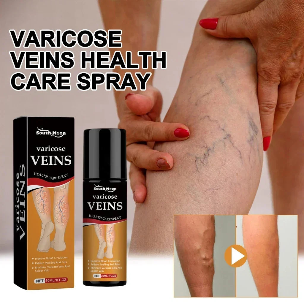 Turmeric Vericose Vein Relief Spray ( Imported )