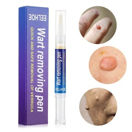 Warts, Moles & Skin Tag Remover Pen