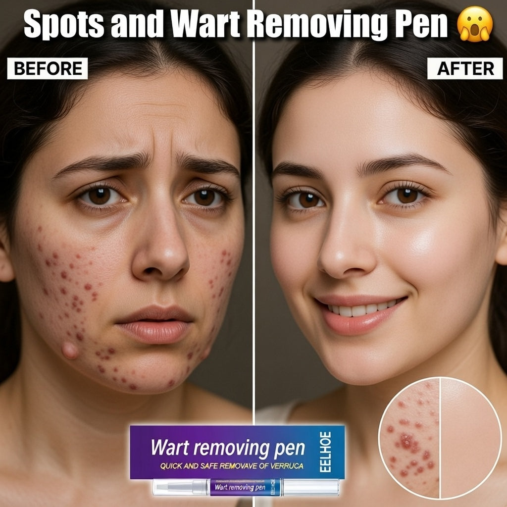Warts, Moles & Skin Tag Remover Pen
